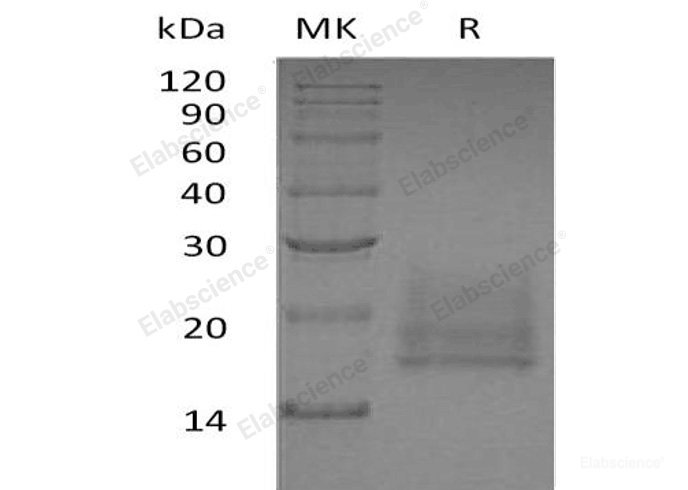 Recombinant Human CEACAM8/CD66b Protein(C-6His)-Elabscience