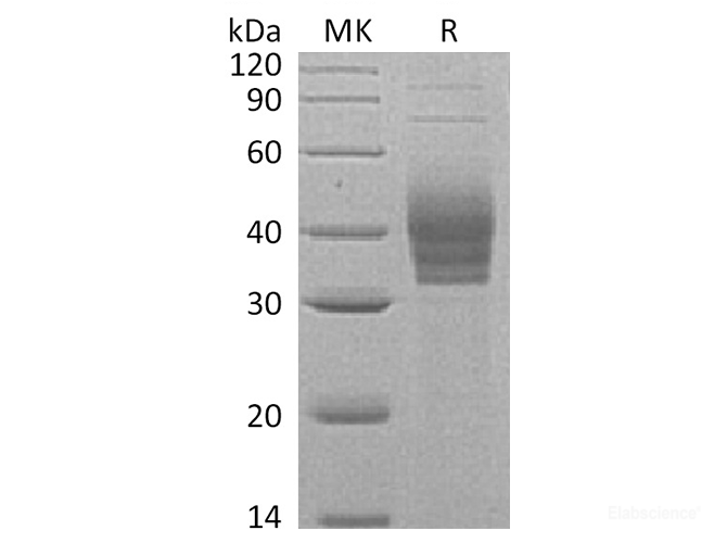 Recombinant Human Cerberus 1/DAND4 Protein(C-6His)-Elabscience
