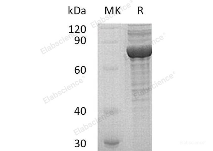 Recombinant Human cGMP-Dependent Protein Kinase 1/PRKG1 Protein(C-6His)-Elabscience