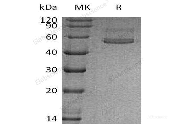 Recombinant Human Chitotriosidase-1/CHIT1 Protein(C-6His)-Elabscience