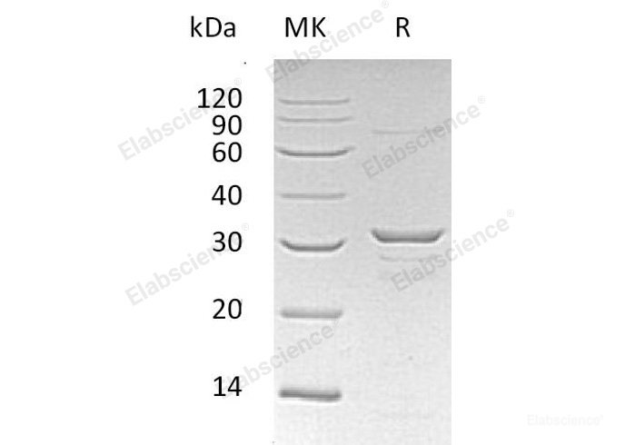 Recombinant Human Chloride Intracellular Channel Protein 1/CLIC1 Protein(N-6His)-Elabscience