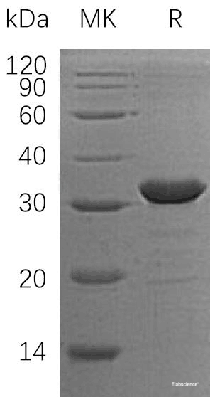 Recombinant Human Chloride Intracellular Channel Protein 2/CLIC2 Protein(N-6His)-Elabscience