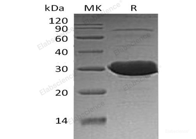 Recombinant Human Chloride Intracellular Channel Protein 3/CLIC3 Protein(C-6His)-Elabscience