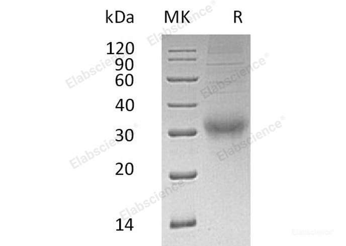 Recombinant Human Choriogonadotropin Subunit β/CGB5 Protein(C-6His)-Elabscience