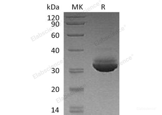 Recombinant Human Chymotrypsin-Like Elastase Family Member 3A/CELA3A Protein(C-6His)-Elabscience