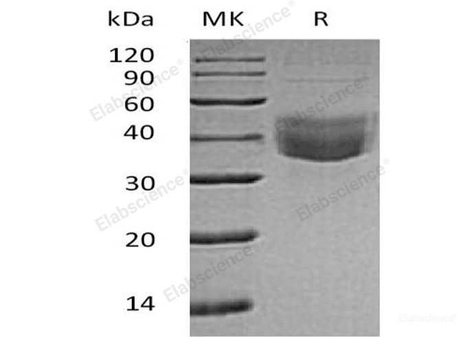 Recombinant Human CLEC10A/CD301 Protein(C-6His)-Elabscience