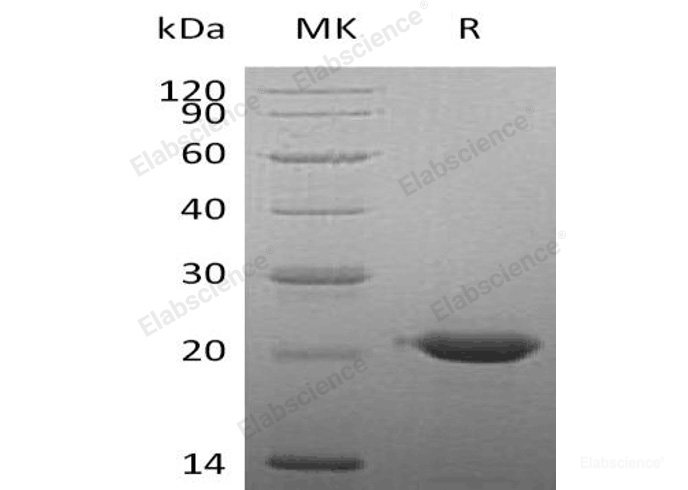 Recombinant Human CLEC3B/Tetranectin Protein(C-6His)-Elabscience