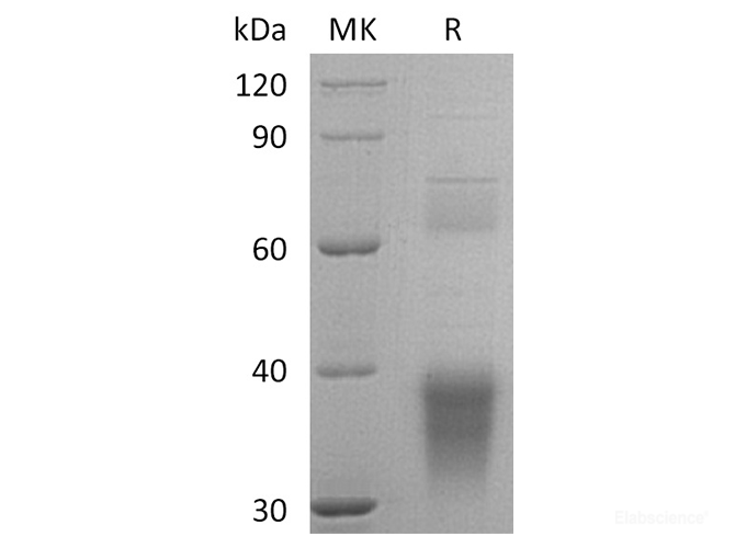 Recombinant Human Clusterin/ApoJ Protein(C-6His)-Elabscience