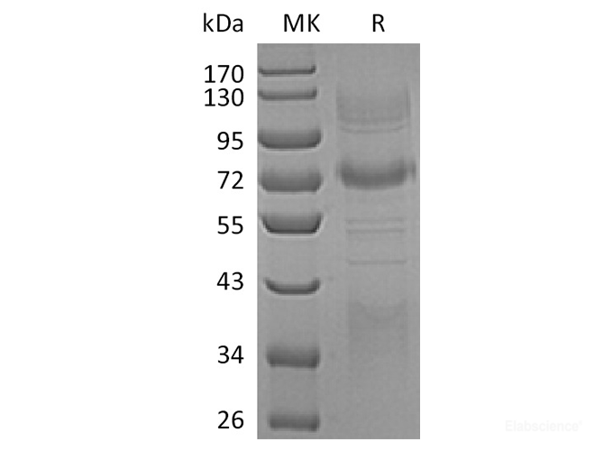 Recombinant Human Clusterin/ApoJ Protein(C-Fc-6His)-Elabscience