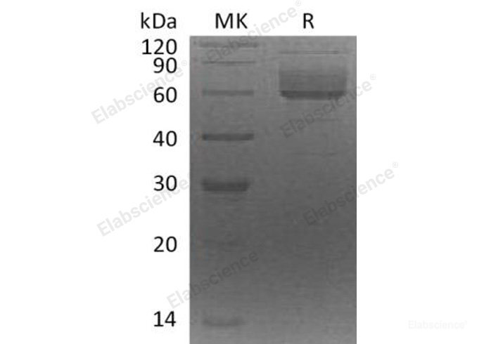 Recombinant Human Clusterin-Like Protein 1/CLUL1 Protein(C-6His)-Elabscience