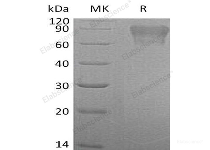 Recombinant Human Coagulation Factor IX/F9 Protein(C-6His)-Elabscience