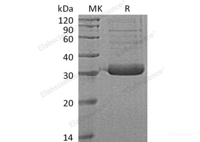 Recombinant Human Collectin-11/COLEC11 Protein(C-6His)-Elabscience