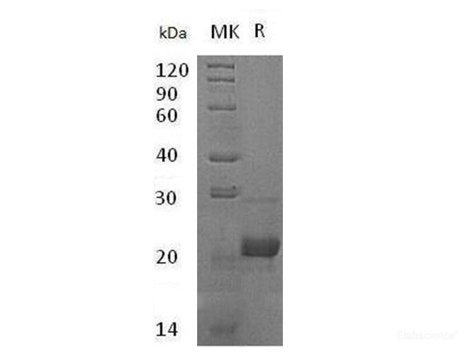 Recombinant Human Complement Component C8 γ Chain/C8G Protein(N-6His)-Elabscience