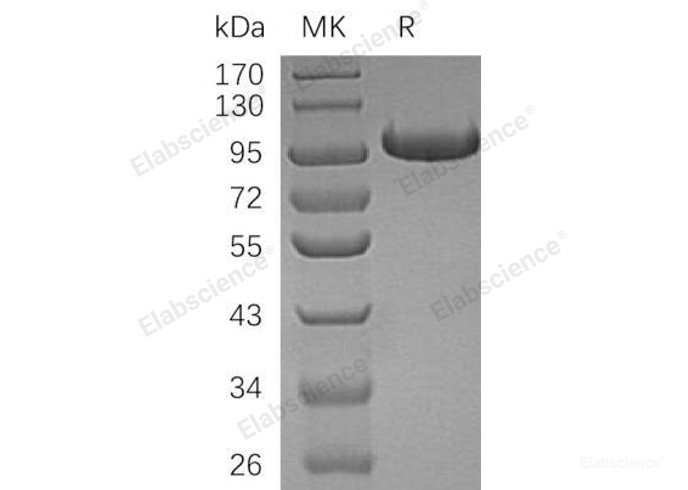 Recombinant Human Complement Factor B/CFB Protein(C-6His)-Elabscience