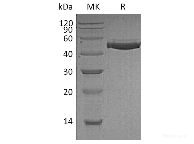 Recombinant Human Complement Factor H/CFH Protein(C-6His)-Elabscience