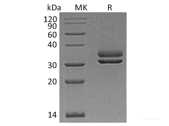 Recombinant Human Complement Factor H-Related Protein 2/CFHR2 Protein(C-6His)-Elabscience