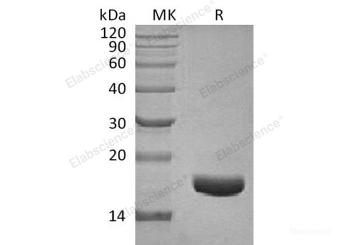 Recombinant Human Connective Tissue Growth Factor/CTGF/CCN2 Protein-Elabscience