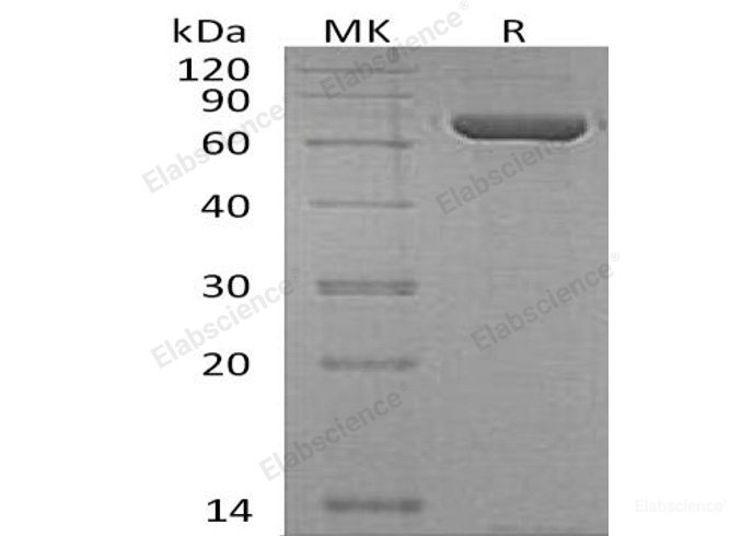 Recombinant Human Copine-1/CPNE1 Protein(N, C-6His)-Elabscience