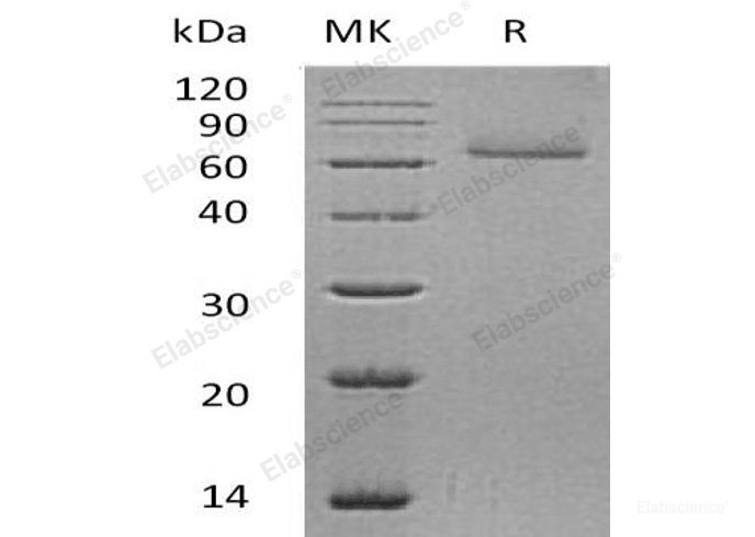 Recombinant Human Corneodesmosin/CDSN Protein(C-6His)-Elabscience