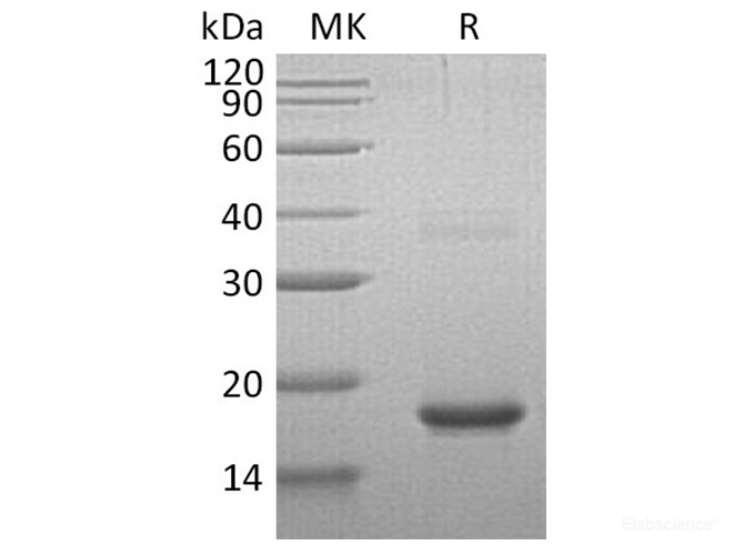 Recombinant Human Cornulin Protein(N-6His)-Elabscience