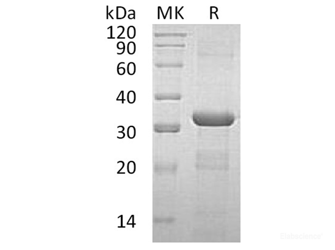 Recombinant Human Coronin-6/CORO6 Protein(N-6His)-Elabscience