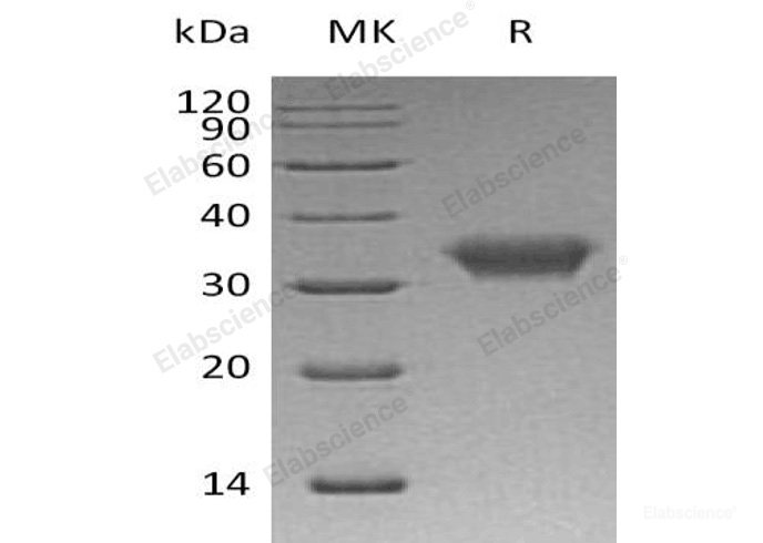Recombinant Human Coxsackievirus and Adenovirus Receptor/CAR/CXADR Protein(C-6His)-Elabscience