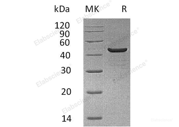 Recombinant Human Creatine Kinase, Muscle/CKMM Protein(C-6His)-Elabscience