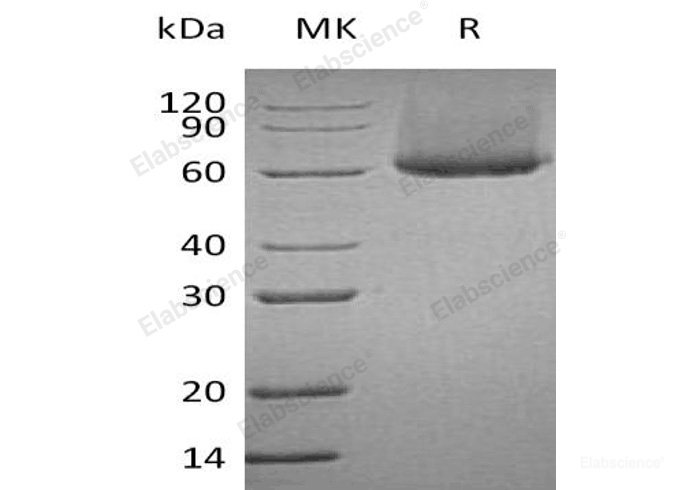 Recombinant Human CRTAMV/CD355 Protein(C-6His)-Elabscience