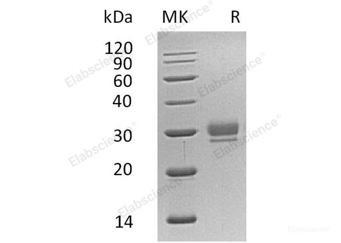 Recombinant Human CTHRC1/NMTC1 Protein(C-6His)-Elabscience