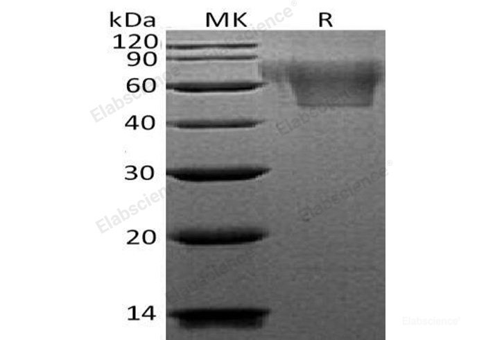 Recombinant Human C-X3-C Motif Chemokine 1/CX3CL1/Fractalkine Protein(C-6His)-Elabscience