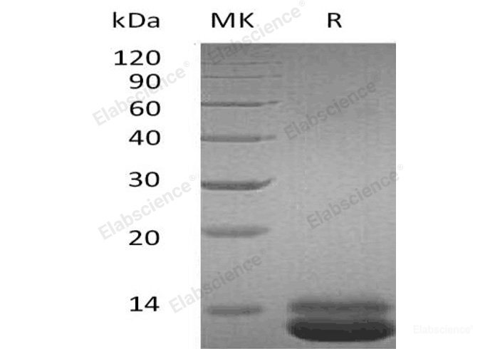 Recombinant Human C-X-C Motif Chemokine 1/CXCL1 Protein(C-6His)-Elabscience
