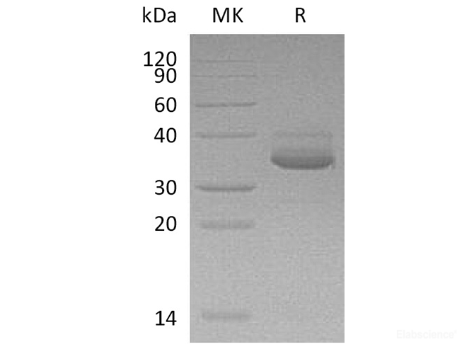 Recombinant Human C-X-C Motif Chemokine 10/CXCL10 Protein(C-Fc-6His)-Elabscience