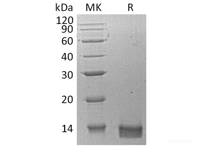 Recombinant Human C-X-C Motif Chemokine 14/CXCL14 Protein-Elabscience
