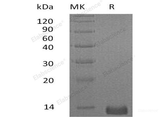 Recombinant Human C-X-C Motif Chemokine 4/CXCL4/PF4 Protein(C-6His)-Elabscience