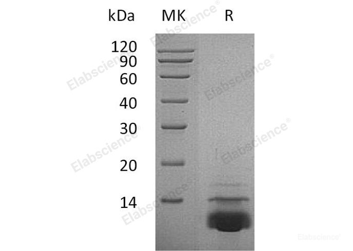 Recombinant Human C-X-C Motif Chemokine 5/CXCL5 Protein-Elabscience