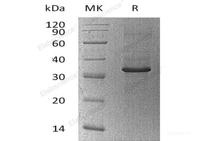 Recombinant Human Cyclophilin C/PPIase C/PPIC Protein(N-Trx, 6His)-Elabscience