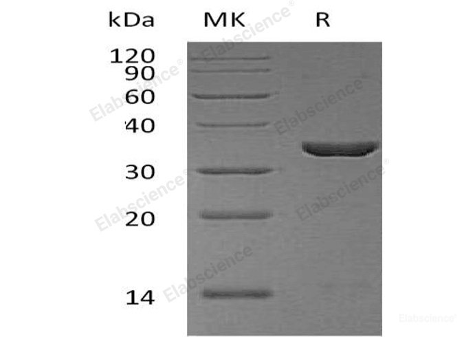 Recombinant Human Cyclophilin E/PPIase E/PPIE Protein(N-6His)-Elabscience