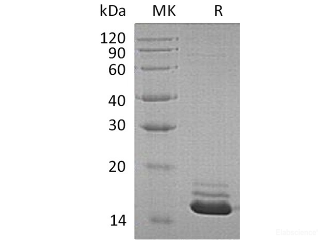Recombinant Human Cystatin C/CST3 Protein(C-6His)-Elabscience