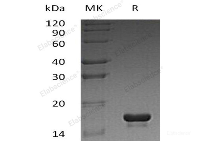 Recombinant Human Cystatin C/CST3 Protein(N-6His)-Elabscience