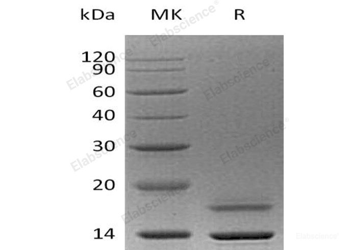 Recombinant Human Cystatin M/CST6 Protein(C-6His)-Elabscience