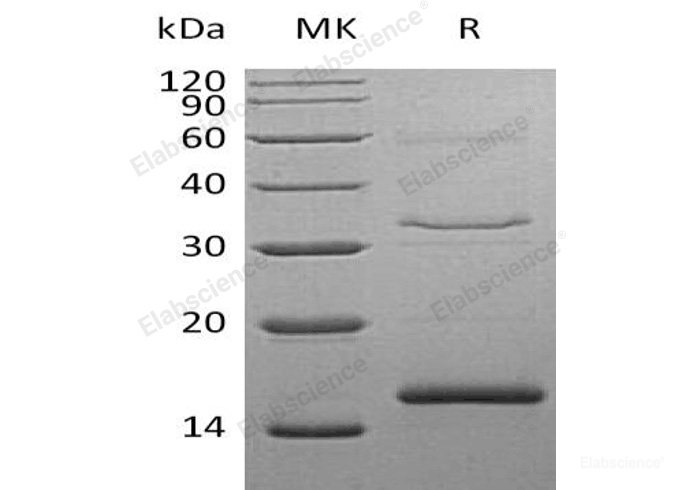 Recombinant Human Cystatin S/CST4 Protein(C-6His)-Elabscience