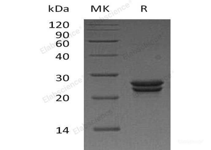 Recombinant Human Cysteine Dioxygenase Type 1/CDO1 Protein(N-6His)-Elabscience