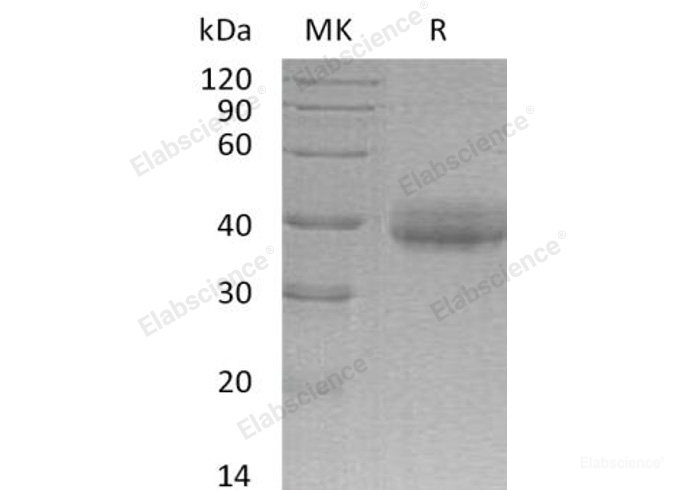 Recombinant Human Cysteine-Rich with EGF-Like Domain Protein 2/CRELD2 Protein(C-6His)-Elabscience