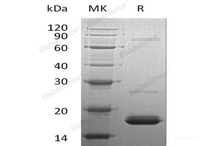Recombinant Human Cytochrome b5/CYB5A Protein(N-6His)-Elabscience