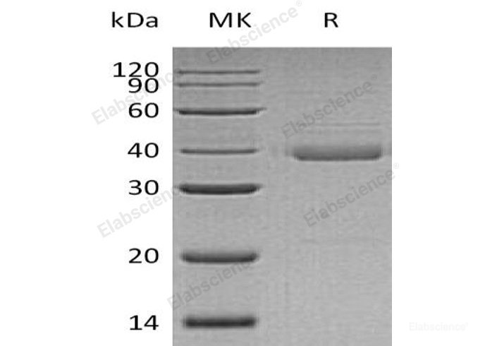 Recombinant Human Cytochrome b-c1 Complex Subunit 6/UQCRH Protein(N-GST)-Elabscience