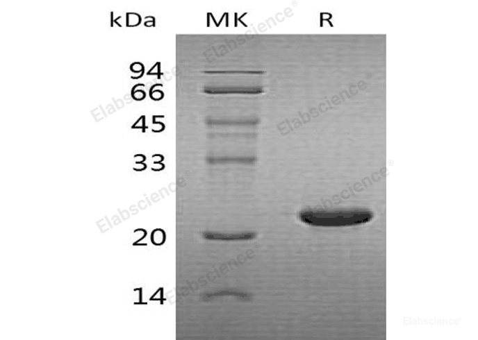 Recombinant Human Cytoglobin/CYGB Protein(C-6His)-Elabscience