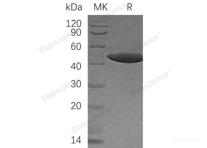 Recombinant Human Cytoplasmic Protein NCK1 Protein(N-6His)-Elabscience