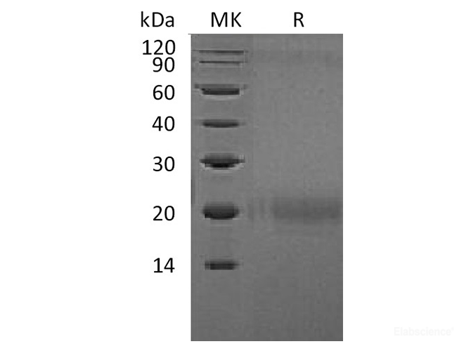 Recombinant Human Cytotoxic T-lymphocyte Protein 4 Protein(C-Flag)-Elabscience