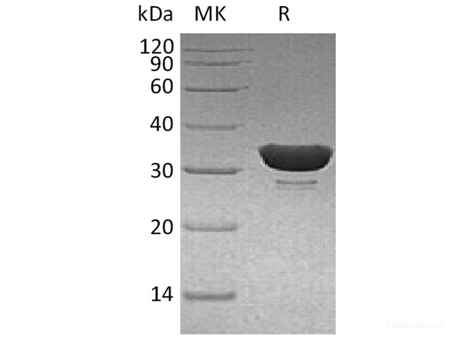 Recombinant Human DCN1-Like Protein 1/DCUN1D1 Protein(N-6His)-Elabscience