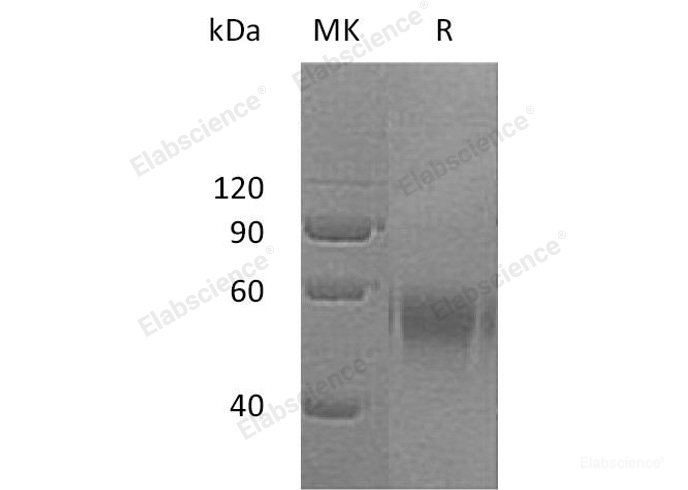 Recombinant Human Death Receptor 6/DR6/TNFRSF21/CD358 Protein(C-Fc)-Elabscience
